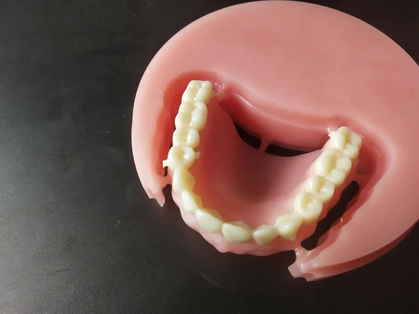 Removable Restorations