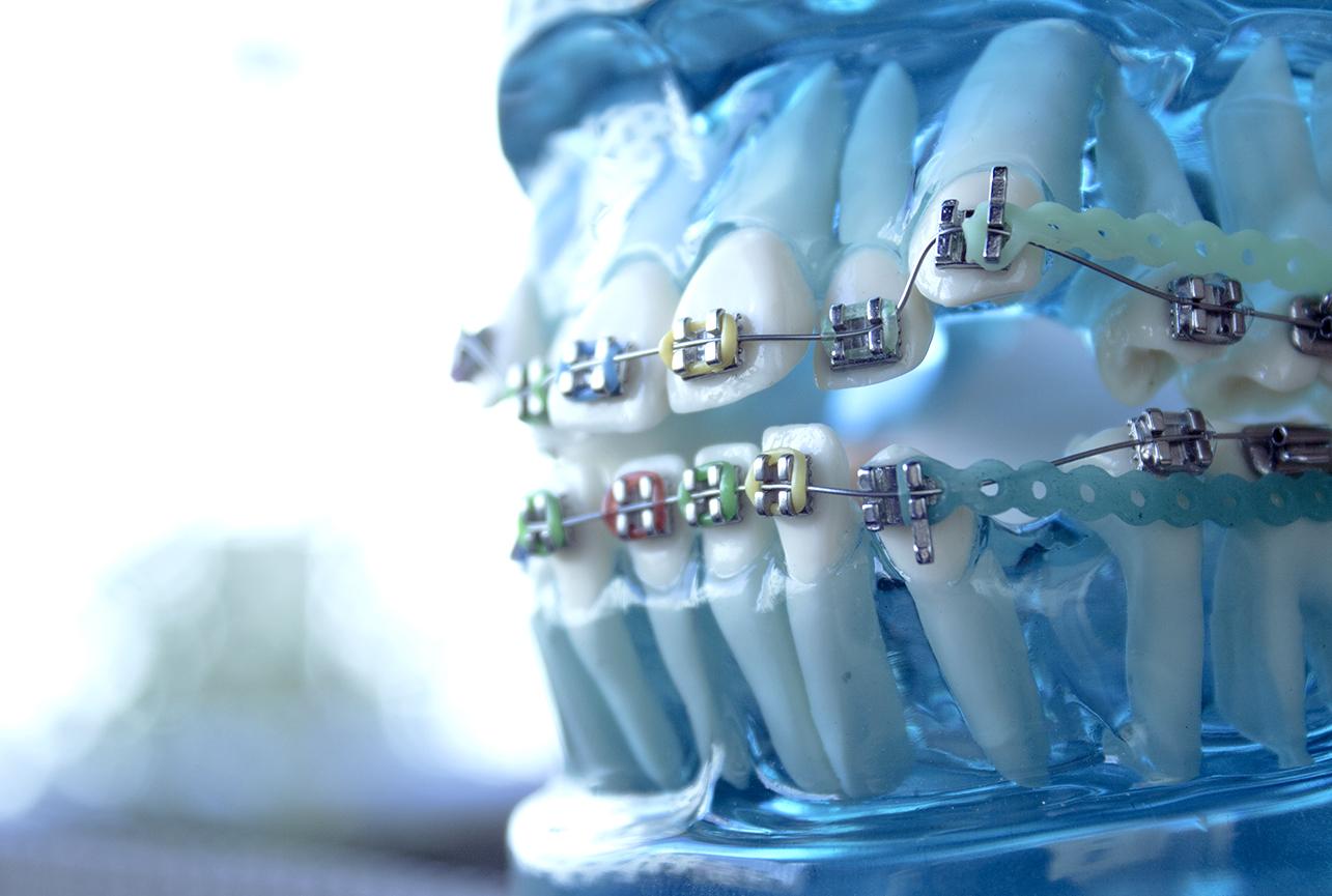 What We Do for Your Teeth