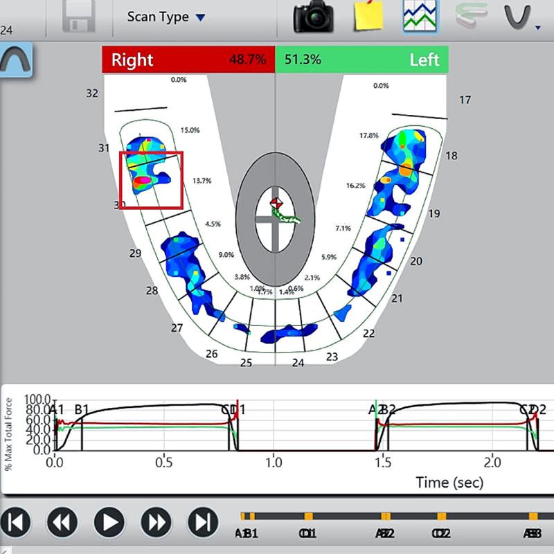 Receive Impression & Scan