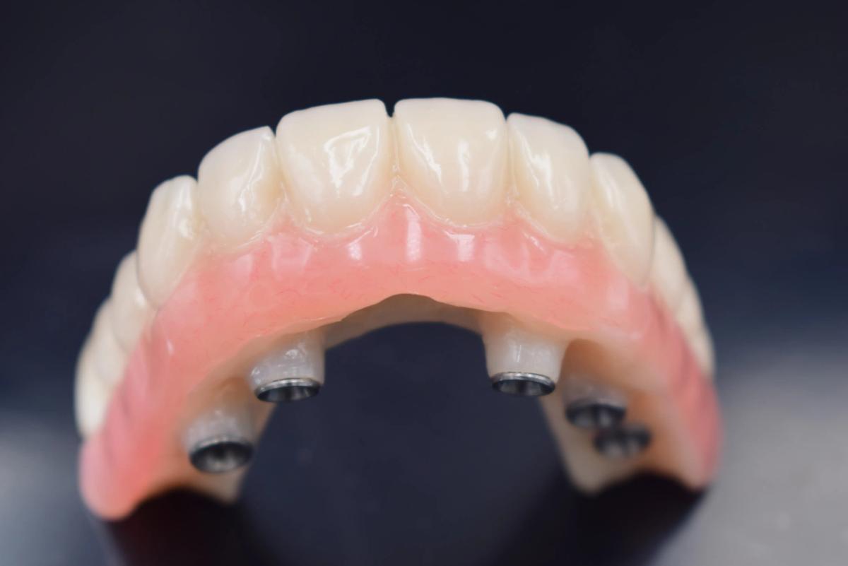 Orthodontics Supplier and Modern Dental Braces