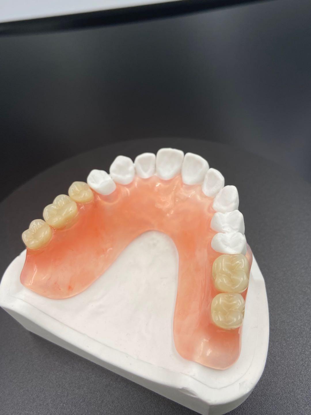 Implants Supplier: Key Attributes for Quality and Innovation