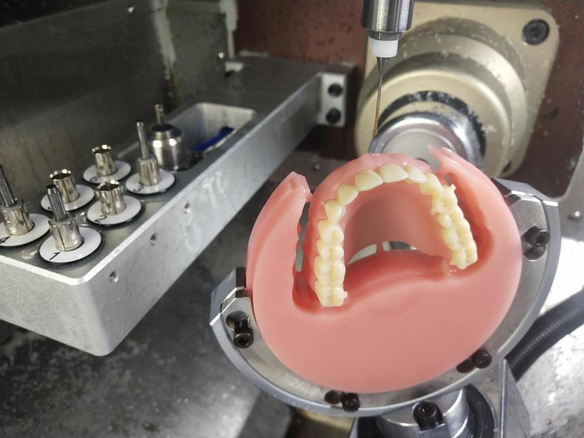 How Modern Dental Lab Services Help Dentists Deliver Accurate Restorations