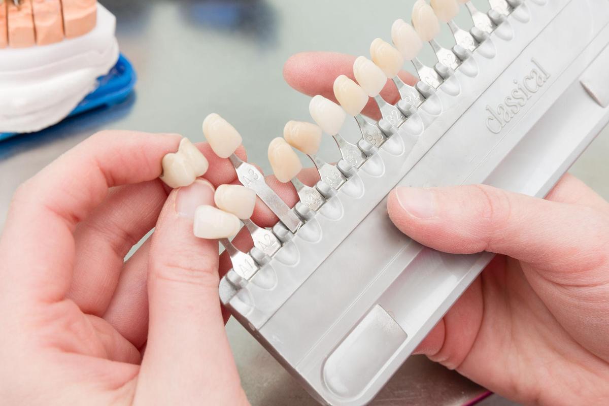Dental Facceers Lab: Soluzioni per un sorriso naturale con un'estetica di precisione