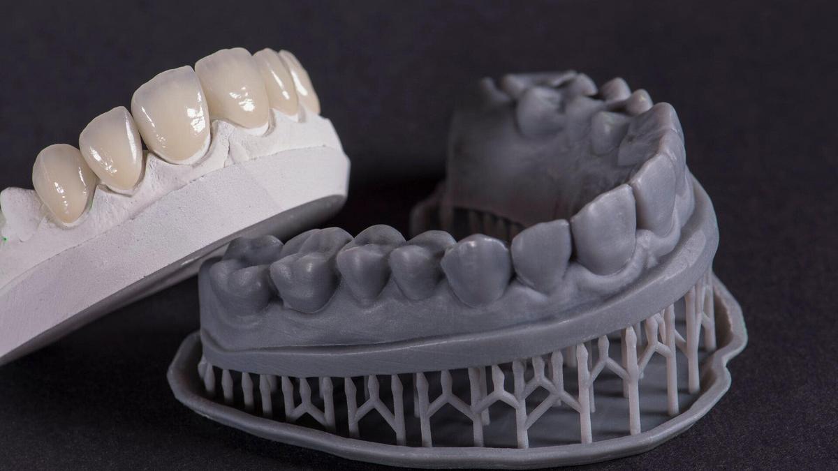 Laboratorio di produzione di faccette dentali: flussi di lavoro di precisione per restauri estetici uniformi