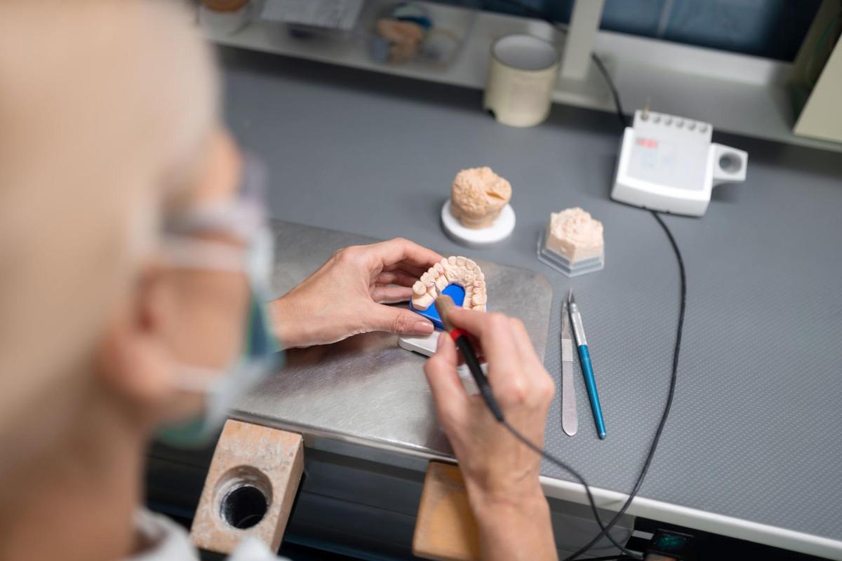 Veneers Manufacturing Service: Scalable Production for Consistent Cosmetic Restorations